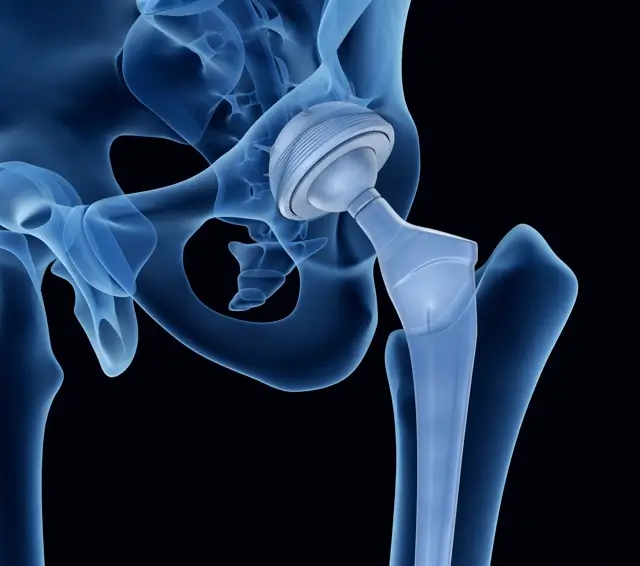 Precision for Better Outcomes