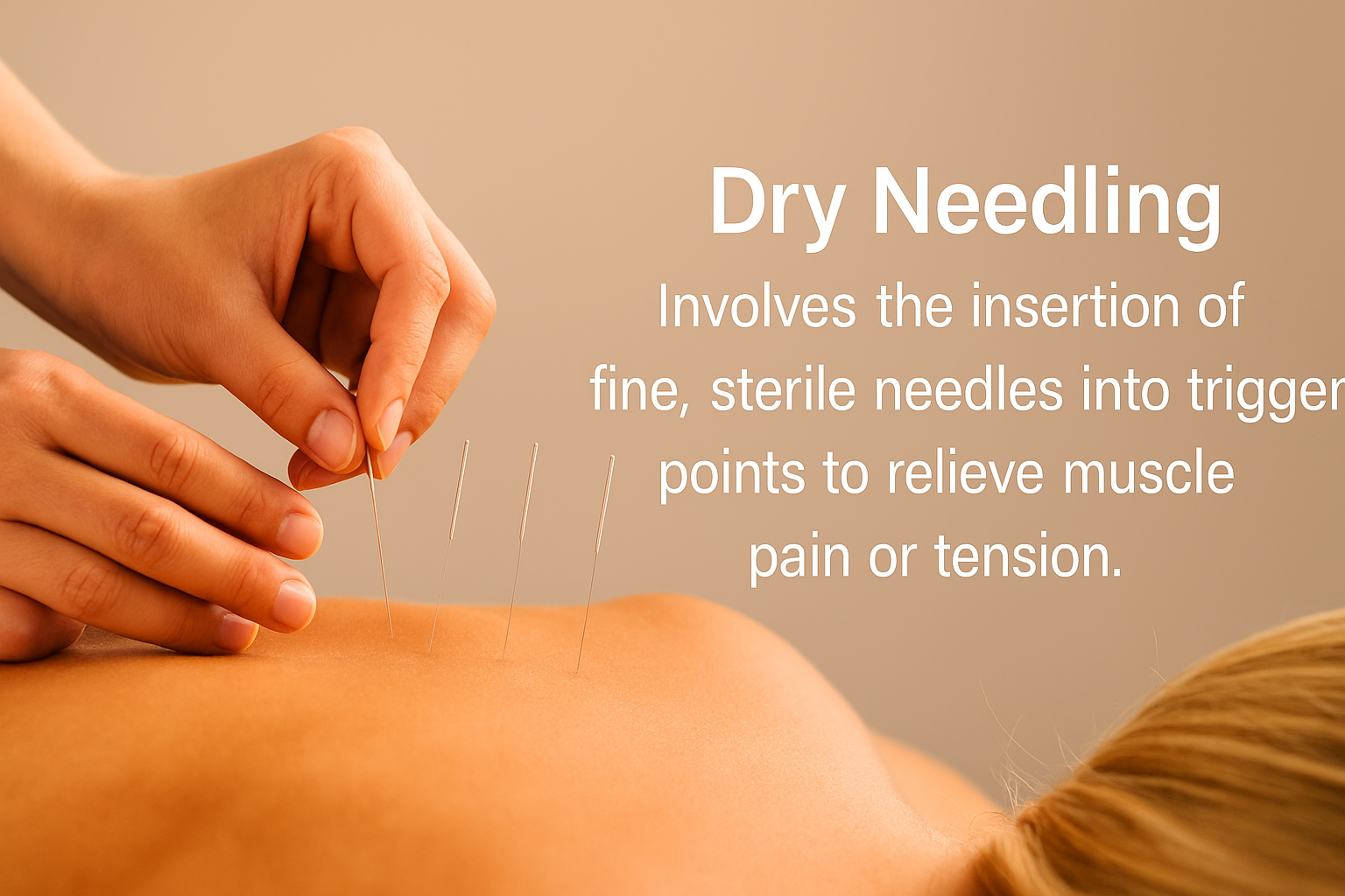 A therapist performing dry needling on a client’s shoulder at ViyUla Beauty Spa in Darwin, targeting muscular trigger points for pain relief and improved mobility.